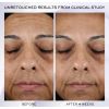 RÉNERGIE HPN 300-ПЕПТИДНЫЙ КРЕМ + ЗАПРАВЛЯЮЩИЙ ДУО